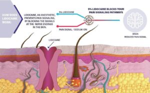 The Science Behind Numbing Cream