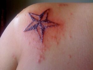 Signs of an Infected Tattoo