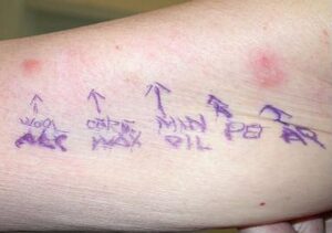 Who Should Avoid Using A&D Ointment