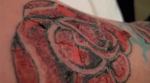 Signs Your Fresh Tattoo May Be Infected