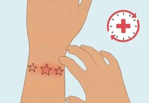 Avoid Scratching or Picking Scabs