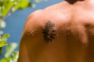 Protecting From Sun Exposure