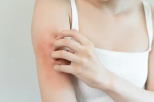 Common Bad Tattoo Aftercare Mistakes