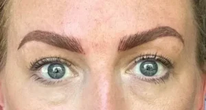 Common Mistakes to Avoid When Using Numbing Cream