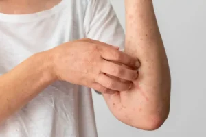 Potential Side Effects of Numbing Cream