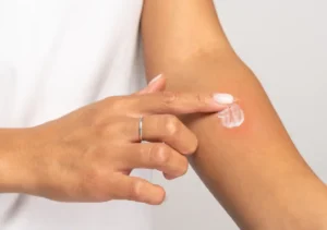 How to Apply