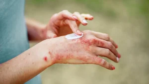 Who Should Avoid Stories & Ink Tattoo Care
