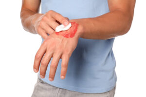 Who Should Use Tattoo Numbing Cream